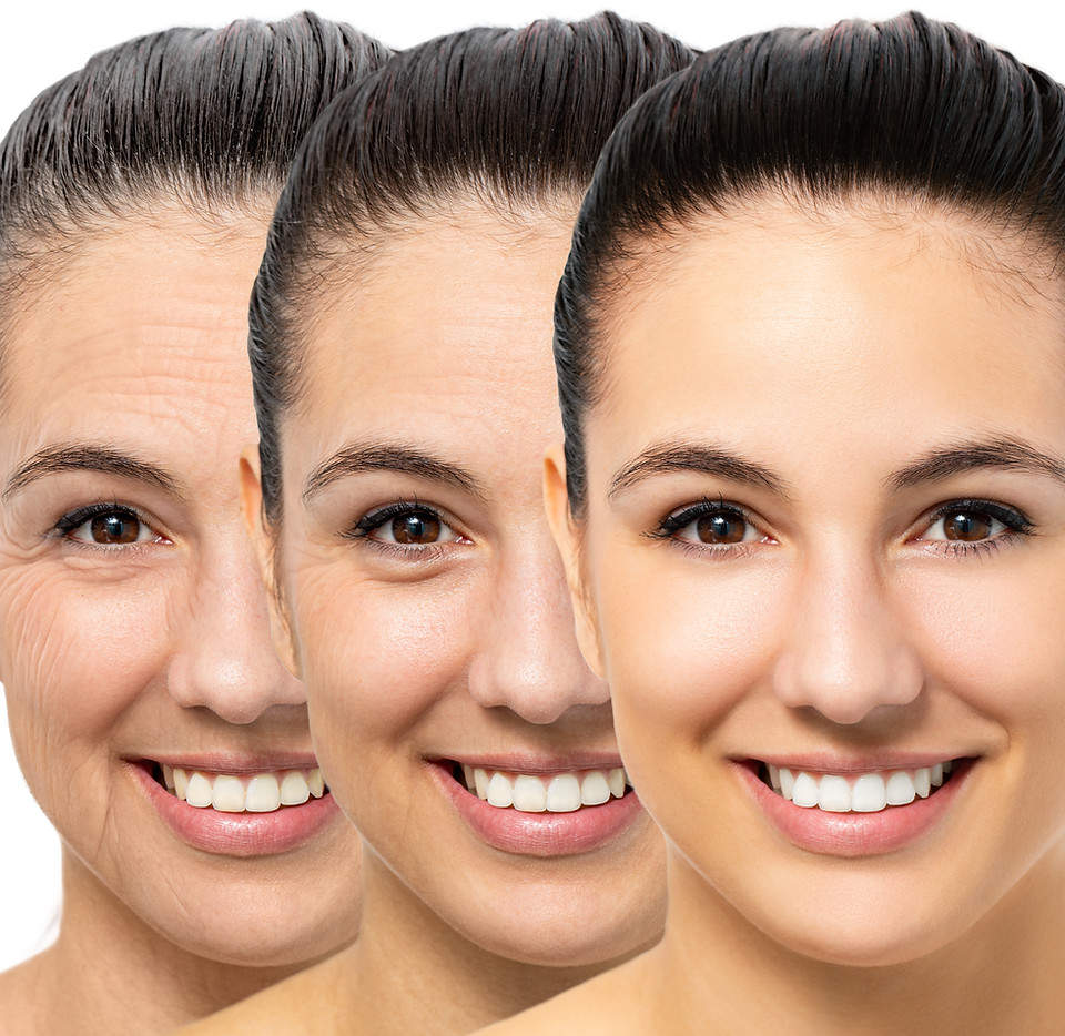 Bio-remodeling-1