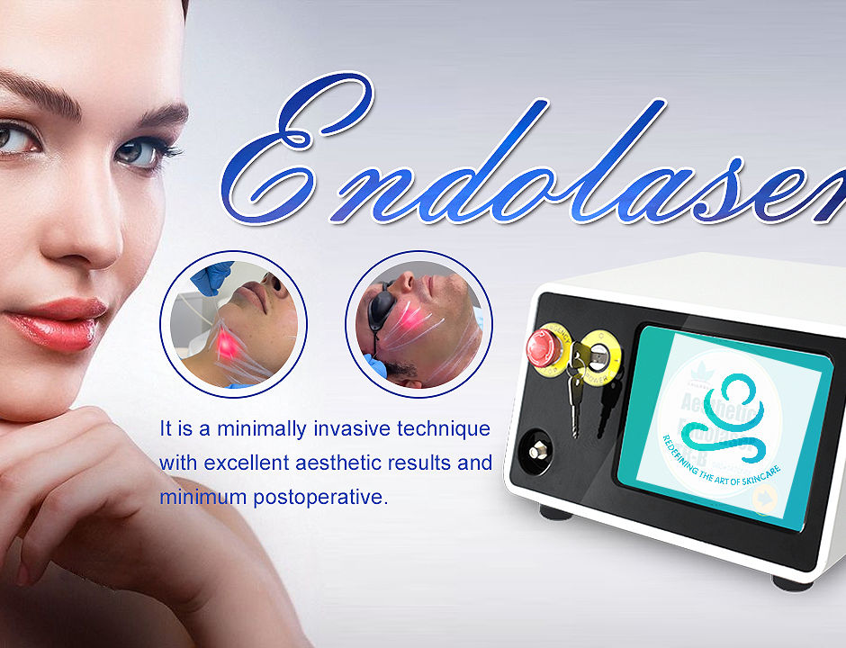 Endolaser (Endolift)
