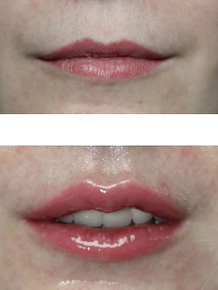 Party Lip