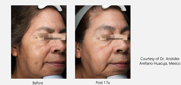Skin Rejuvenations