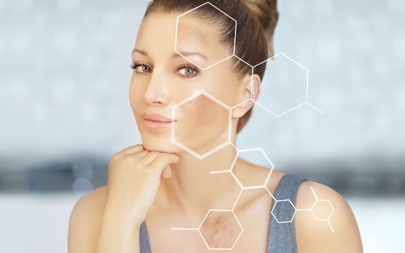 PIGMENTATION & MELASMA
