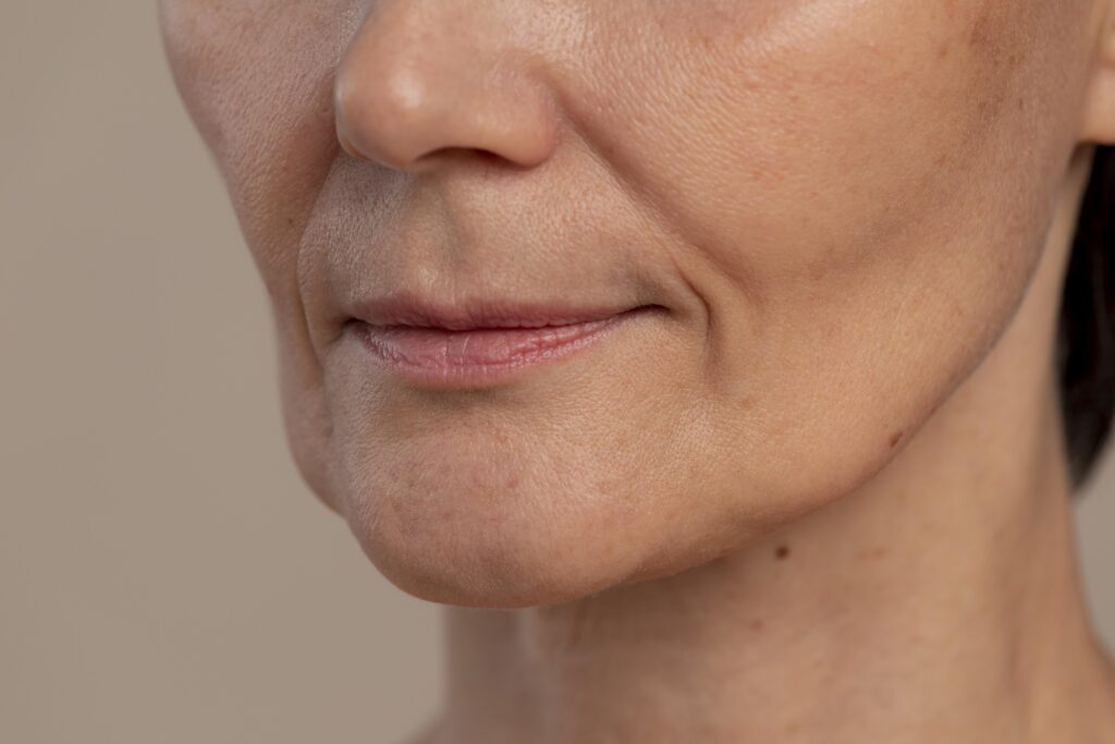 Hollow cheeks