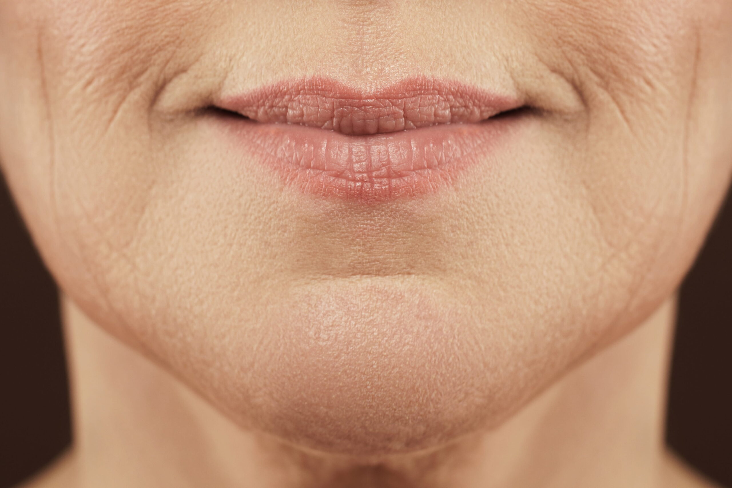 Puffy Cheeks