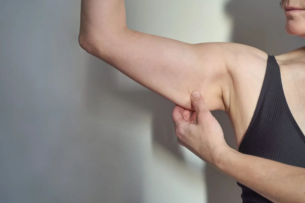 Batwing Arms