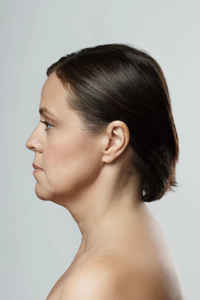 Bulky Jaw Muscle