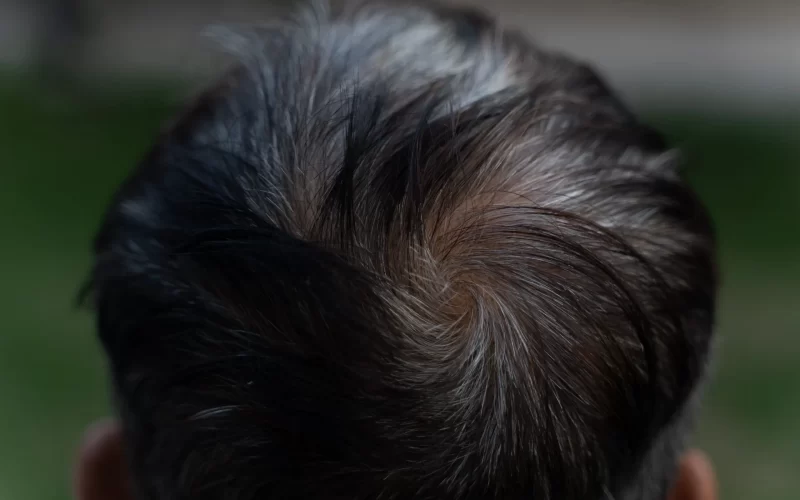 Hair Growth Package