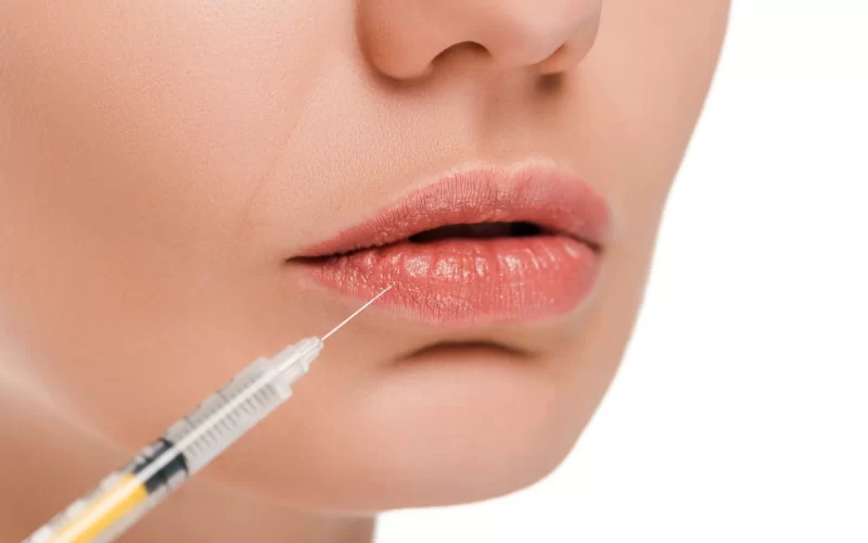 No-Filler lip Rejuvenation