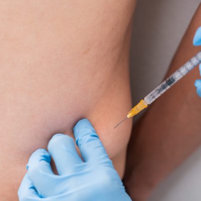 fat-disolving-injection