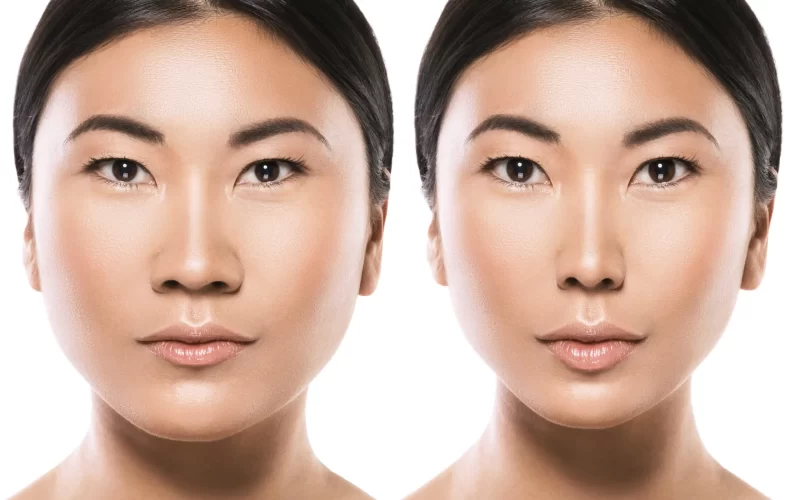 Full Face Transformation
